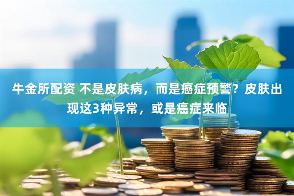 牛金所配资 不是皮肤病，而是癌症预警？皮肤出现这3种异常，或是癌症来临